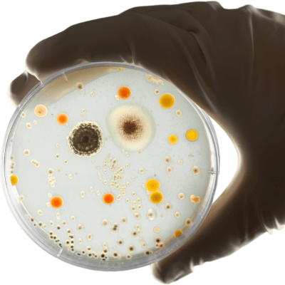 hand holding petri dish with bacteria and mold spores growing